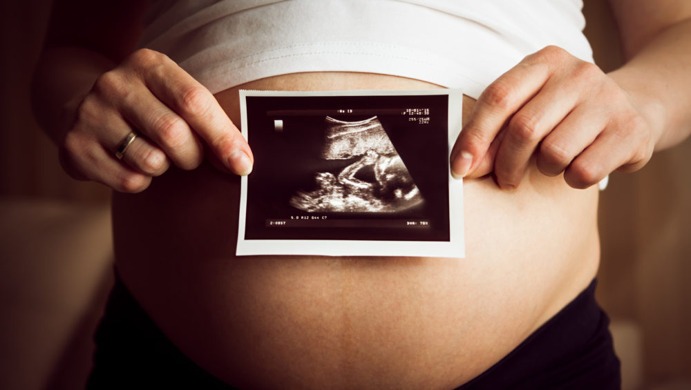 A shot of Pregnant Woman Holding Ultrasound Scan